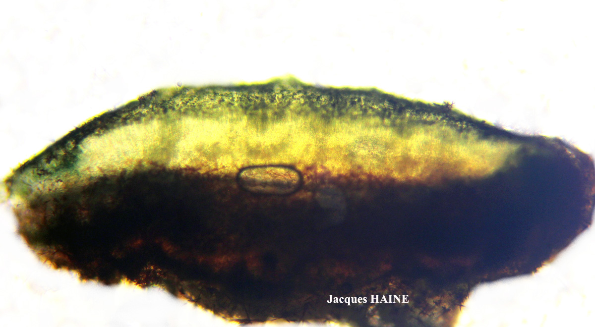 Lecanora praepostera auct. non Nyl.